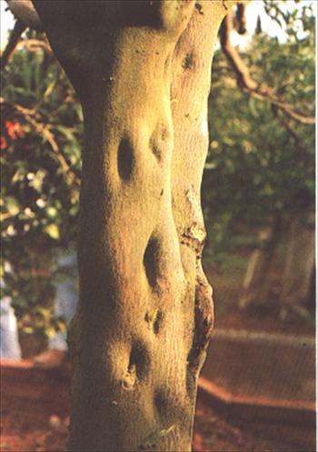 بیماریهای پسوروز